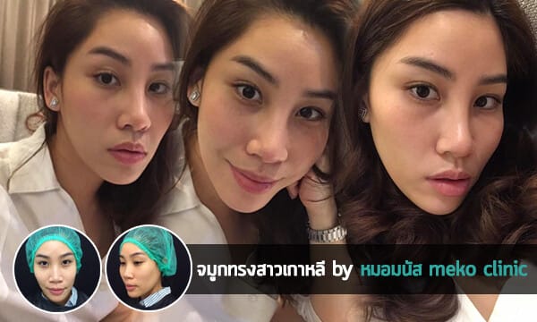 จมูกโด่งแบบสาวเกาหลี