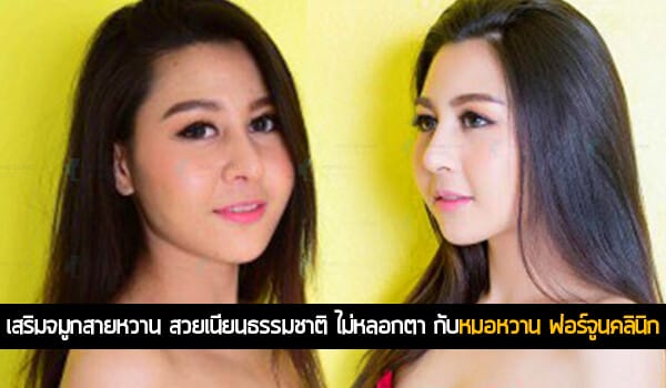 เสริมจมูกสายหวาน