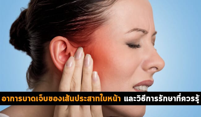 อาการบาดเจ็บของเส้นประสาทใบหน้า