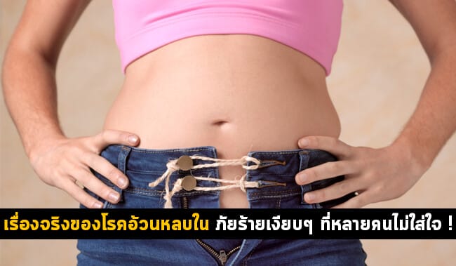 เรื่องจริงของโรคอ้วนหลบใน