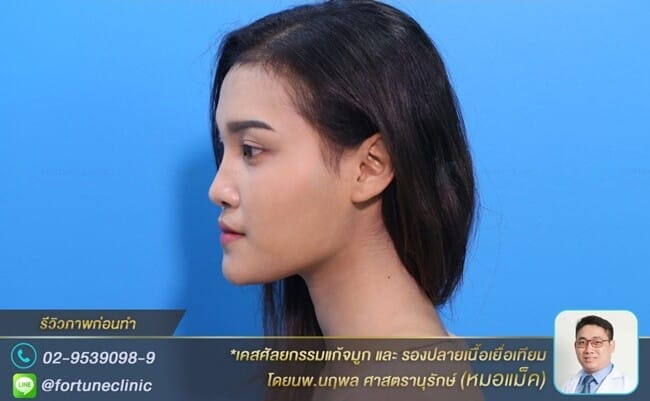 รูปหน้าสวยเพราะองศาจมูกดีขึ้น