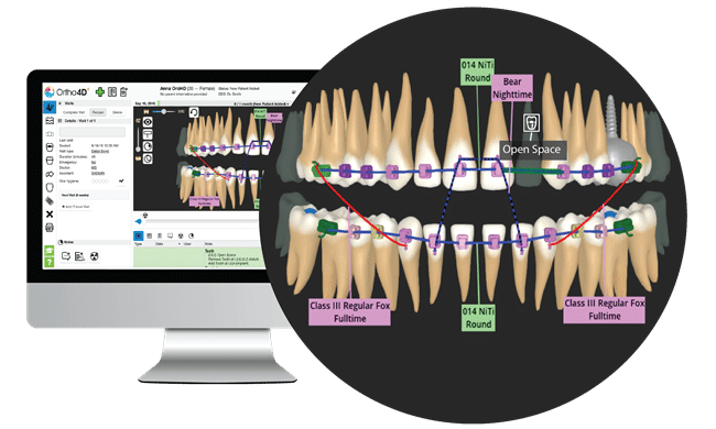 INVISALIGN