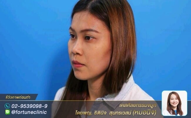 สโลปปลายพุ่งแบบสาวเนื้อน้อย