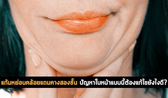 แก้มหย่อนคล้อยแถมคางสองชั้น 