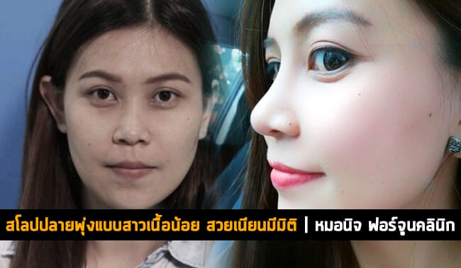 สโลปปลายพุ่งแบบสาวเนื้อน้อย 