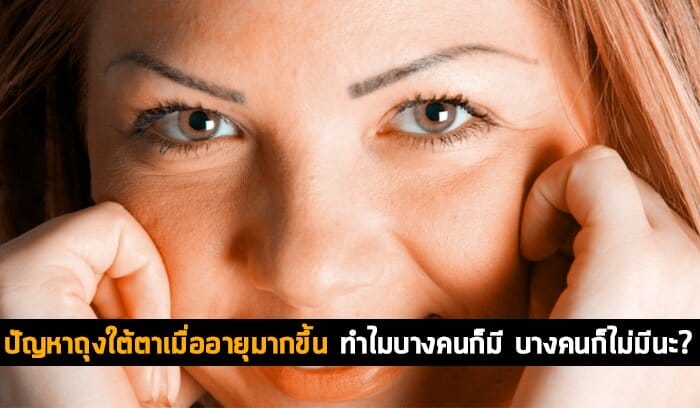 ปัญหาถุงใต้ตาเมื่ออายุมากขึ้น 