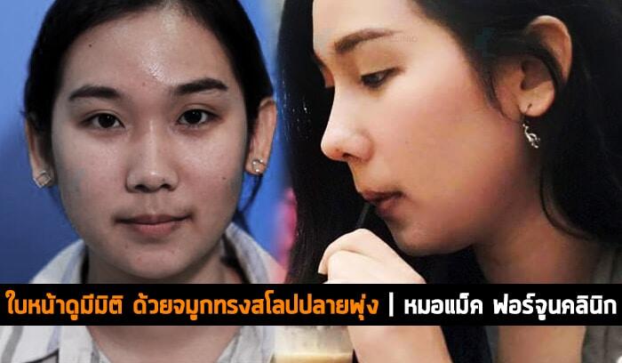 ใบหน้าดูมีมิติ