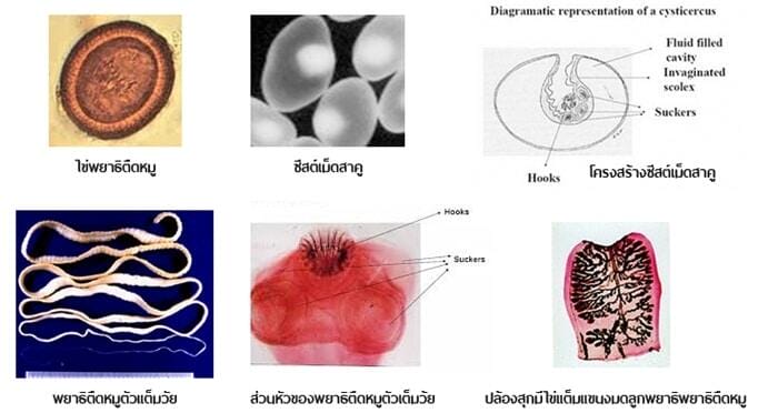 พยาธิตืดหมู