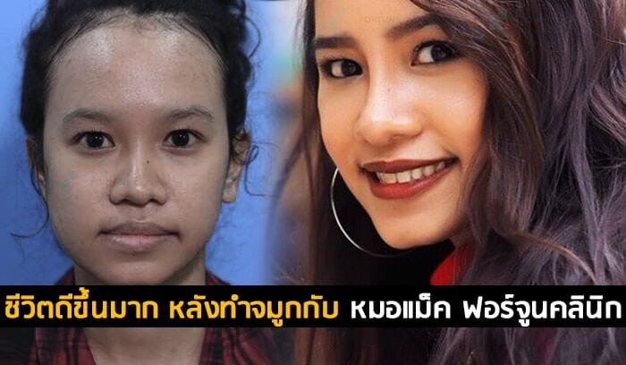 ชีวิตดีขึ้นมาก