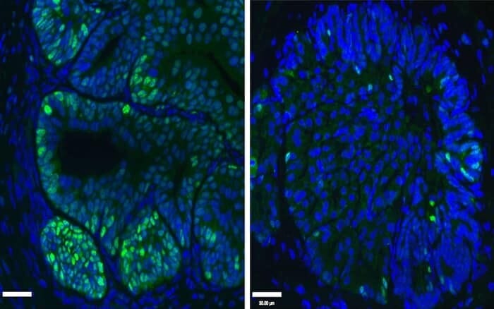 Deguelin, an inhibitor of mitochondria in cells,