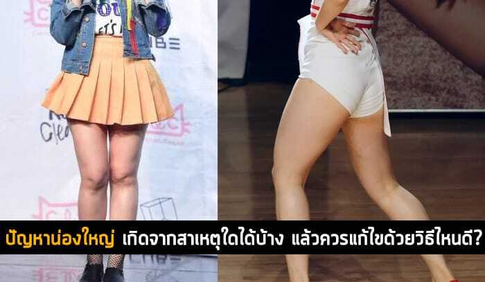 ปัญหาน่องใหญ่