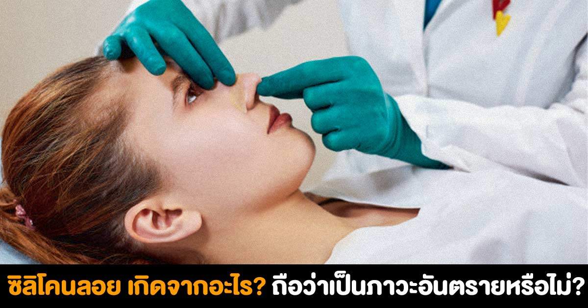 ซิลิโคนลอย เกิดจากอะไร