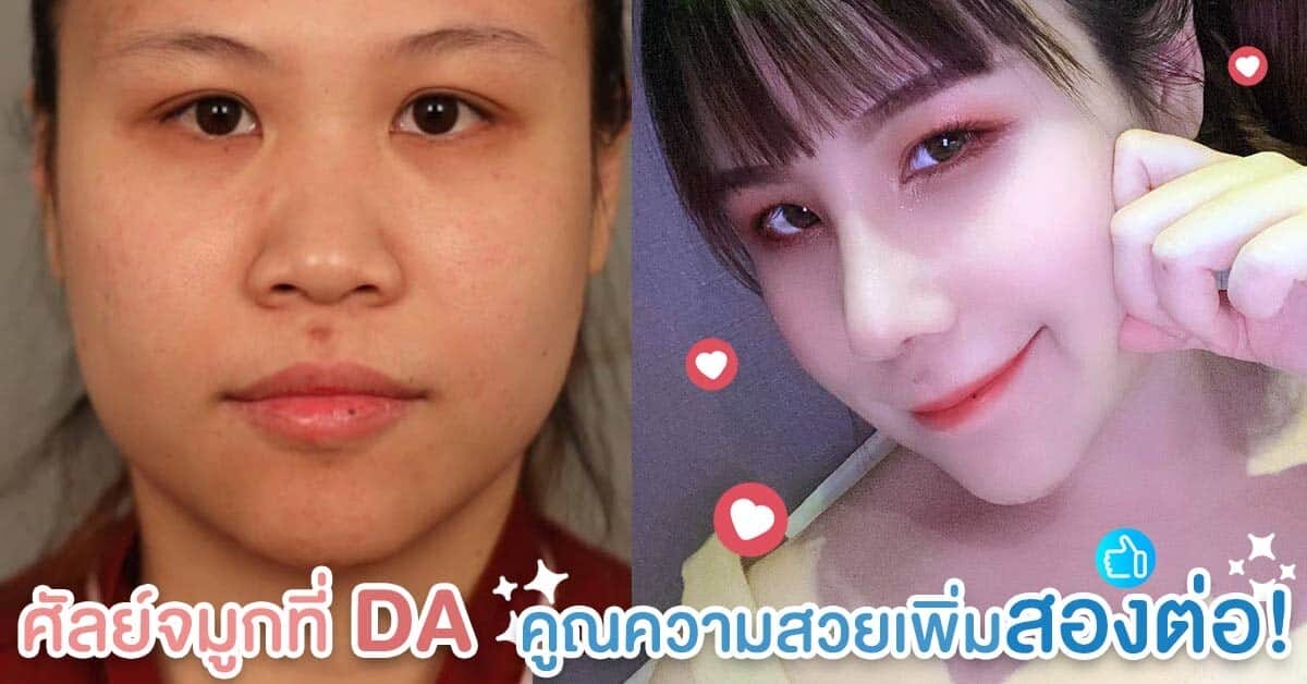 ศัลย์จมูกที่ DA