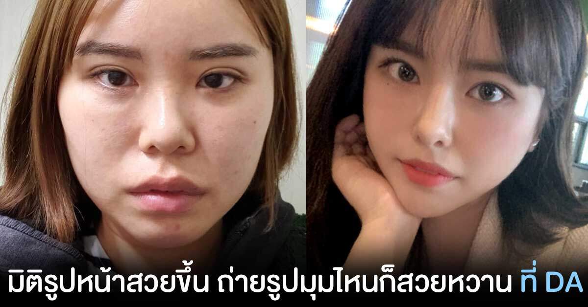 มิติรูปหน้าสวยขึ้น