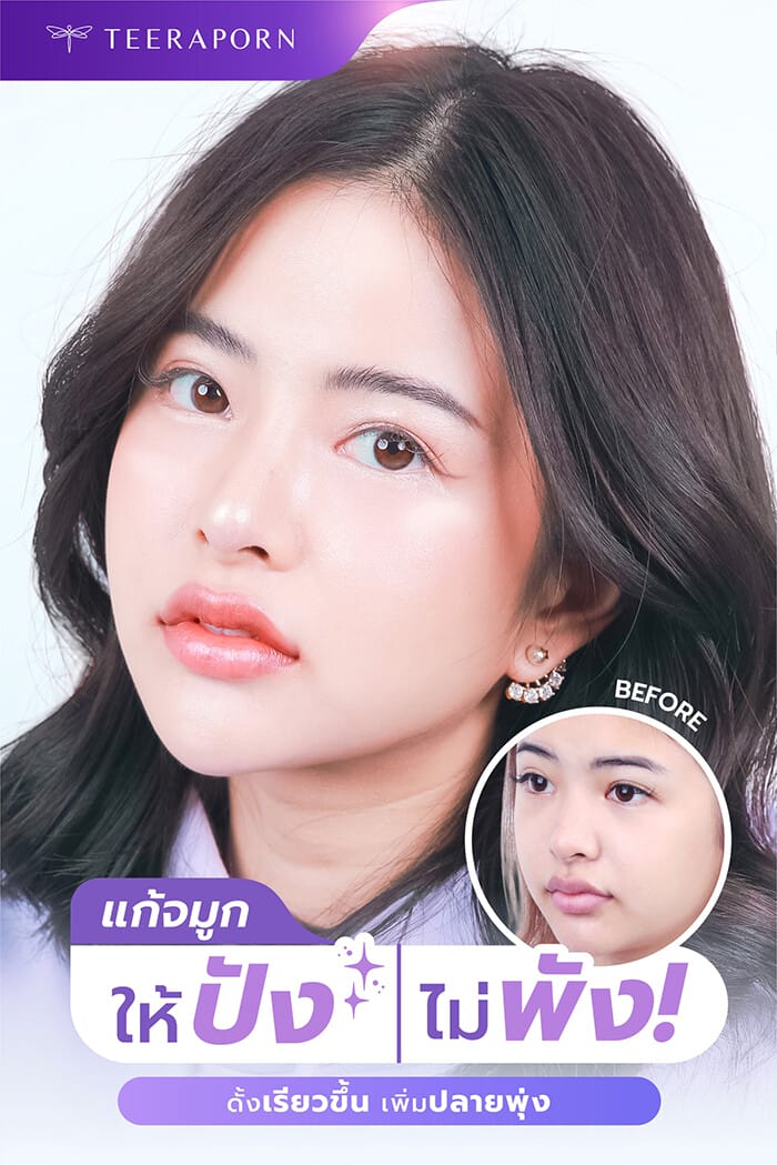 เปลี่ยนซีรีส์ใหม่